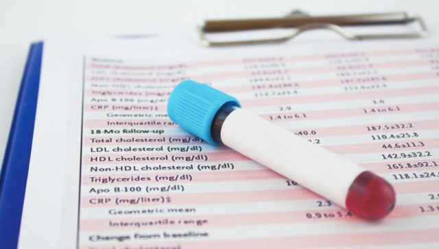 vial of blood on test sheet